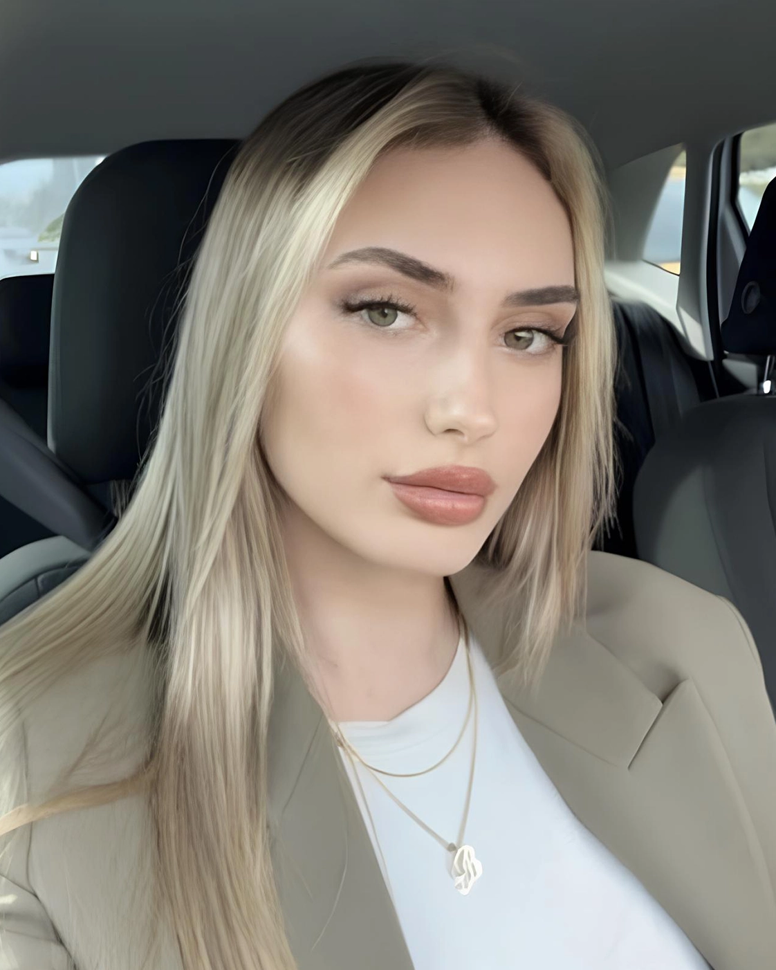 Nasal tip aesthetics (tip plasty)